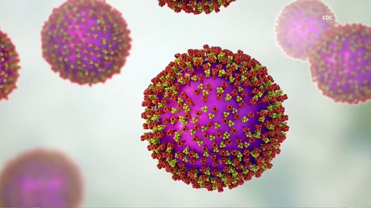 Second measles case of 2026 confirmed in Travis County